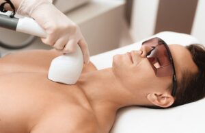 LASER FOR HAIR REMOVAL